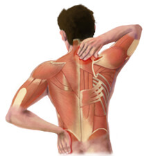 X-Ray View of Back Pain in the Muscles of the Back