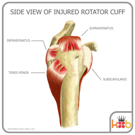 Injured Rotator Cuff