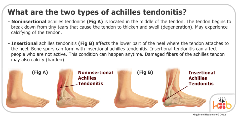 King Brand Two Types of Achilles Tendonitis Image Explanation Diagram Ankle Injuries