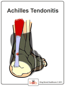 Animation of how the King Brand® BFST® Heals an Achilles Tendonitis Injury