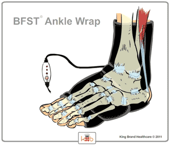 Animation of a BFST® Wrap in Use on an Ankle Tendonitis Injury