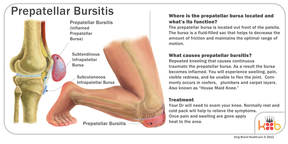 King Brand Knee Injury Image Diagram Bursitis Ice Packs Wraps