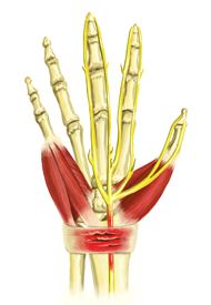 An illustration of a skeletal hand with lots of inflammation