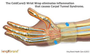 An animation of a King Brand® ColdCure® Wrist Wrap treating the inflammation in a Carpal Tunnel injury