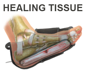 King Brand BFST Wrap Helps Heal Injured Tissue on Foot
