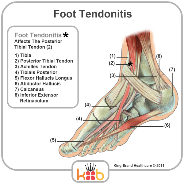 King Brand Foot Tendonitis Tendons Bones Muscles Diagram Labelled Heal Quickly and Painlessly With BFST and Coldcure
