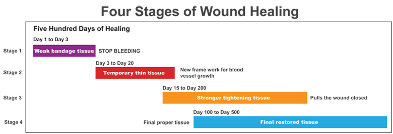 Four Stages of Wound Healing