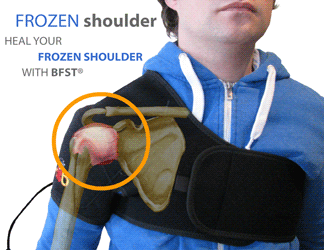 An Overlaid Animation of a King Brand Side Shoulder BFST Wrap Treating a Frozen Shoulder Injury on a Person