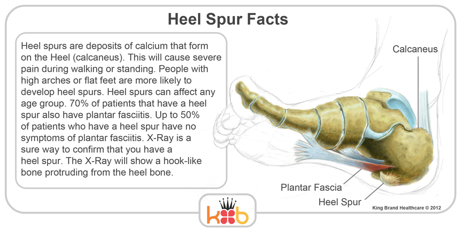 King Brand Heel Spur Injury Solutions Information on Symtoms and Causes and Labelled Diagram