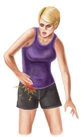 An Illustration of a Woman With a Hip Flexor Injury
