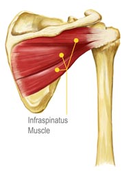 An Informational Diagram of the Infraspinatus Muscle