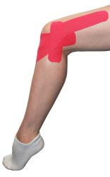 Kingbrand Pink Taping for the Lateral Knee
