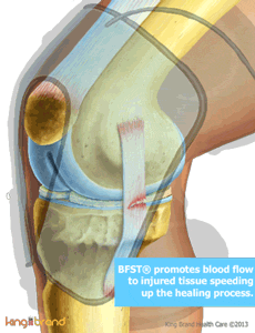 King Brand BFST Blood Flow Stimulation Therapy with MCL Injury Knee Wrap Heal Quickly