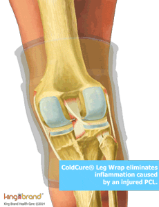 An Animated Skeletal Drawing of the King Brand ColdCure Leg Wrap Treating PCL Inflammation