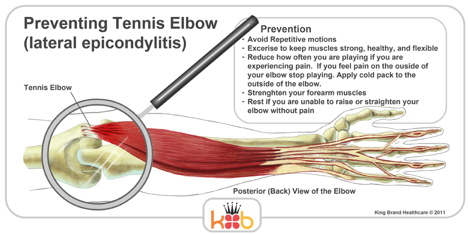 King Brand Tennis Elbow Treatment Injury Prevention Wraps
