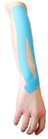 Arm Extensor Tendonitis 2 Inch Tape Application