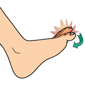 Foot Flexor Tendonitis Signs and symptoms