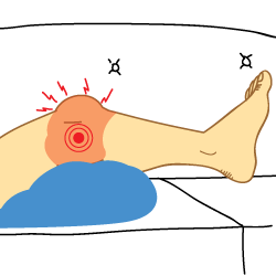 Kingbrand Illustration of Syptoms for an ACL and PCL Tear