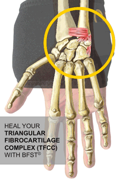 An animation of a King Brand® BFST Wrist Wrap being used to stimulate blood flow to treat a Triangular Fibrocartilage injury