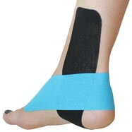 Tarsal Tunnel Syndrome Tape Application