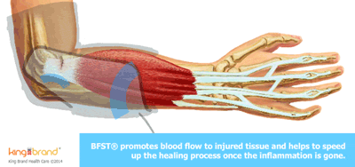 Animation of the BFST® Working on a Tennis Elbow Injury
