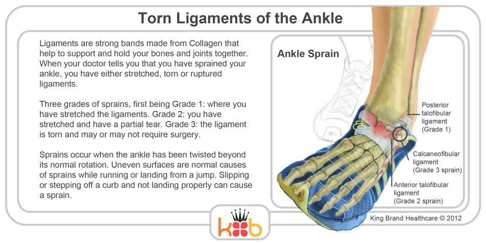 King Brand Ankle Ligaments Image Diagram Running Injuries